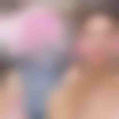 Μπάλες πάγου για μασάζ προσώπου (2 τεμ.) | GLACIE